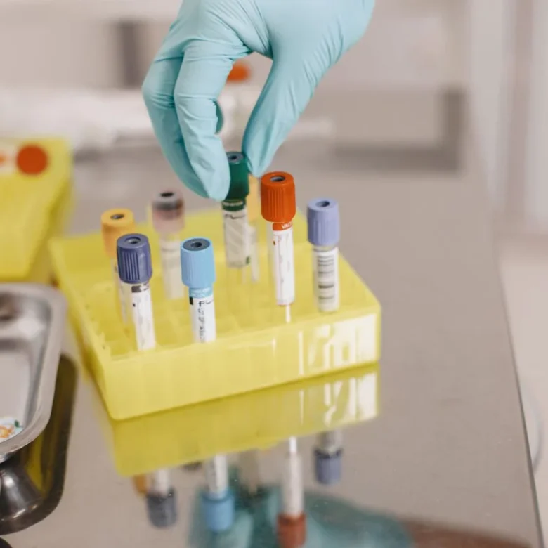 How Food Sensitivity Testing Reveals Hidden Inflammation